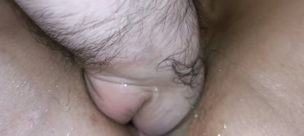 Vaginal fistin